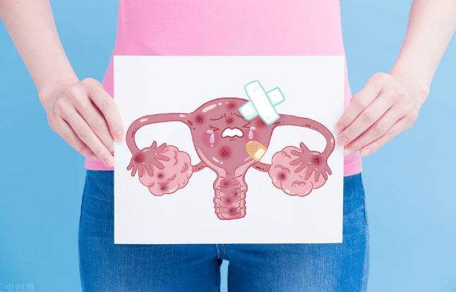 子宫肌瘤“偏爱”同一类女性，她们大多有这个特点