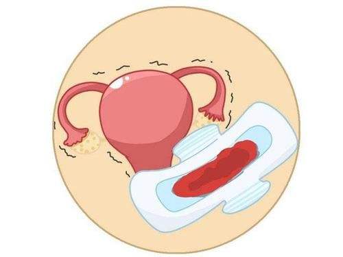 子宫功能性出血是什么原因造成的，该怎么办