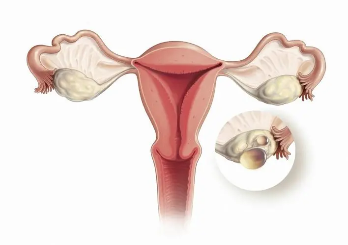 卵巢功能异常的表现有哪些，怎么治
