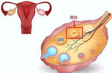 卵巢黄体破裂是怎么回事