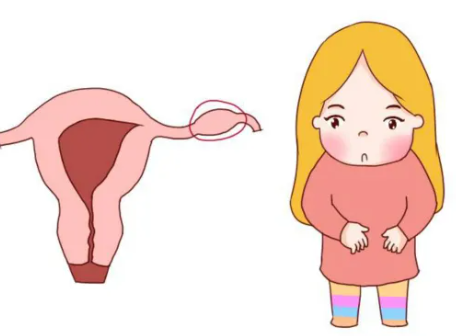 宫外孕必须要切除输卵管吗