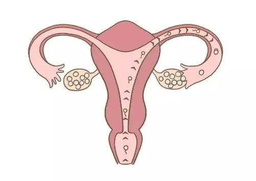 输卵管哪些问题会导致不孕