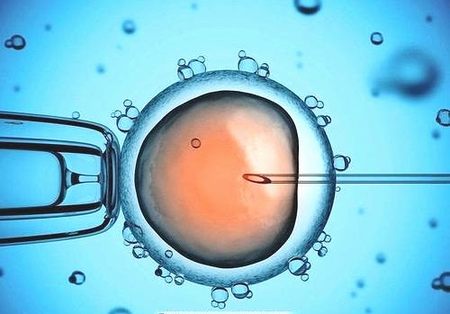 取卵后多久知道受精情况，取卵受精后需要培养多久才能进行移植手术？