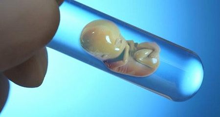 移植冻胚后第二天可以侧睡吗，建议冻胚移植可改善怀孕率
