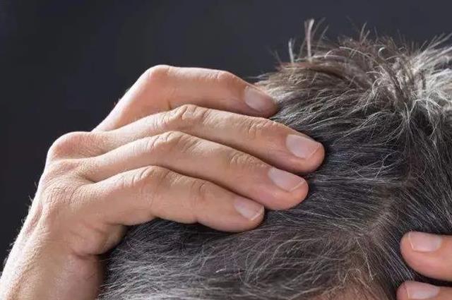 重点公布：三个部位长白发最危险，不仅影响健康且伤身