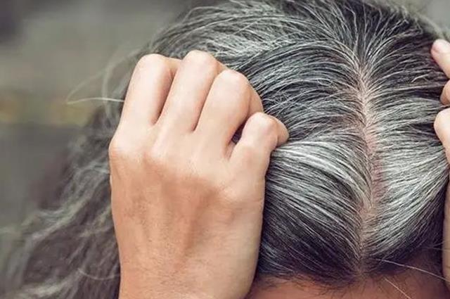 重点公布：三个部位长白发最危险，不仅影响健康且伤身