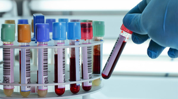 最常用的肾功能检查方式汇总，抽血验尿必不可少