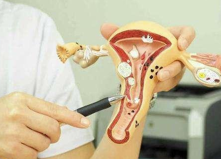 子宫肌瘤为什么会导致女性不孕