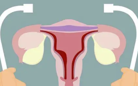 残角子宫畸形可以正常怀孕吗