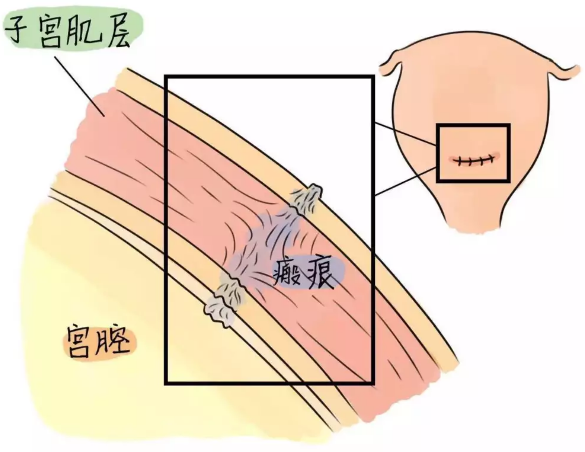 重庆送子鸟医院