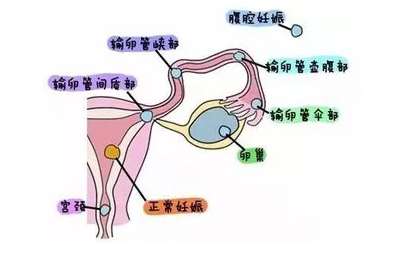 重庆送子鸟医院