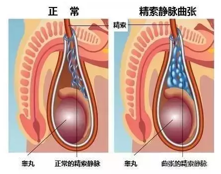 重庆送子鸟医院